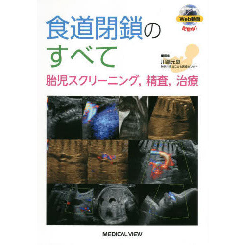 【超お買い得！】 食道閉鎖のすべて 胎児スクリーニング，精査，治療 通販｜セブン 語学+参考書