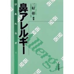 鼻アレルギー
