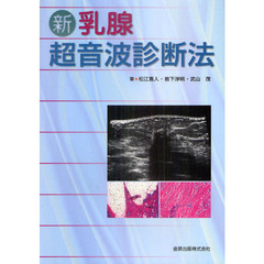 新乳腺超音波診断法