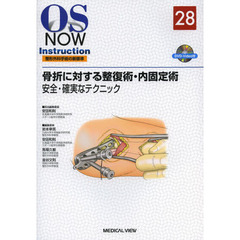 骨折に対する整復術・内固定術　安全・確実なテクニック