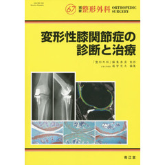 変形性膝関節症の診断と治療