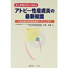 アトピー性皮膚炎の最新知識　そこが知りたいＱ＆Ａ　日本皮膚科学会患者相談システムに学ぶ