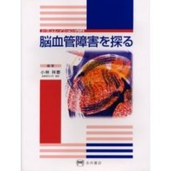 脳血管障害を探る
