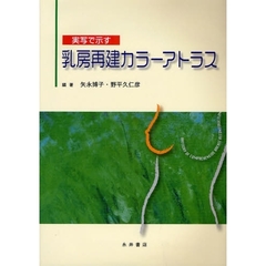 乳房再建カラーアトラス　実写で示す
