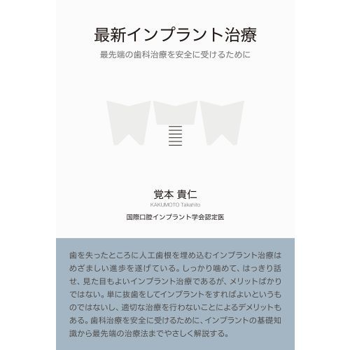 最新インプラント治療 最先端の歯科治療を安全に受けるために 通販