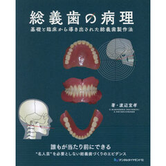 総義歯の病理　基礎と臨床から導き出された総義歯製作法