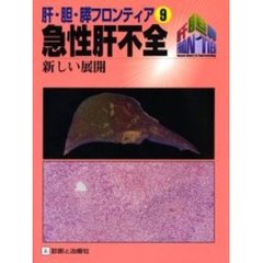 急性肝不全　新しい展開
