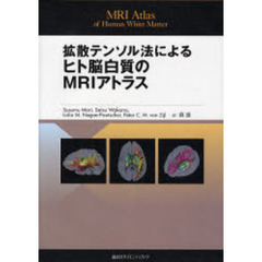 拡散テンソル法によるヒト脳白質のＭＲＩアトラス