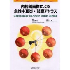 内視鏡画像による急性中耳炎・鼓膜アトラス