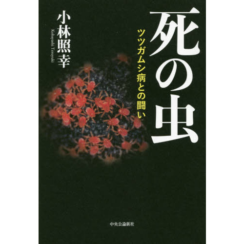 死の虫 ツツガムシ病との闘い 通販｜セブンネットショッピング