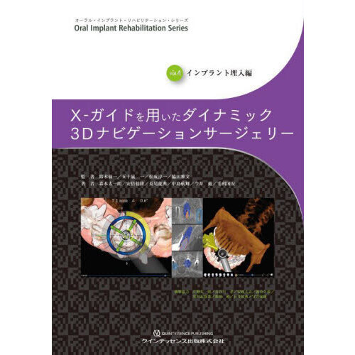 X-ガイドを用いたダイナミック3Dナビゲーションサージェリー