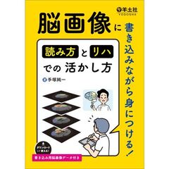 脳画像に書き込みながら身につける！読み方とリハでの活かし方