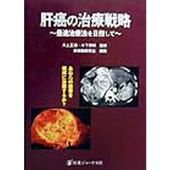 肝癌の治療戦略　最適治療法を目指して　あなたの患者を如何に治療するか？