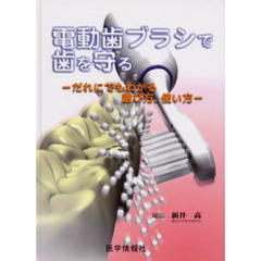 電動歯ブラシで歯を守る　だれにでもわかる選び方，使い方