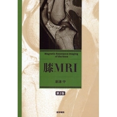 膝ＭＲＩ　第２版