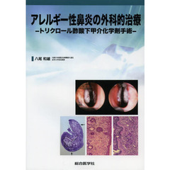 アレルギー性鼻炎の外科的治療　トリクロール酢酸下甲介化学剤手術