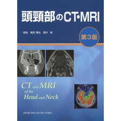 頭頸部のＣＴ・ＭＲＩ　第３版
