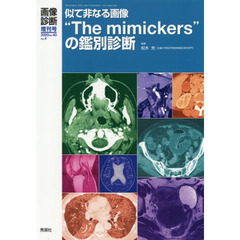 画像診断2020年増刊号(Vol.40 No.4) 似て非なる画像“The mimickers”の鑑別診断