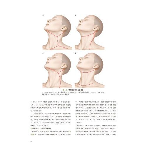 深頸筋膜の解剖学的構造から学ぶ頸部郭清術
