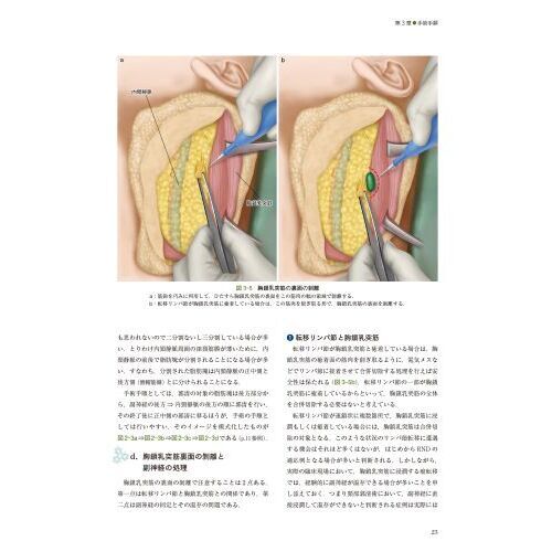 深頸筋膜の解剖学的構造から学ぶ頸部郭清術