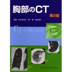 胸部のＣＴ　第２版