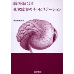 脳損傷による視覚障害のリハビリテーション