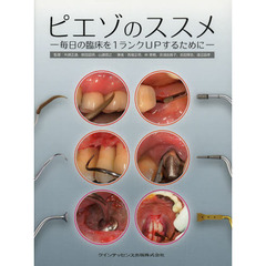 ピエゾのススメ　毎日の臨床を１ランクＵＰするために