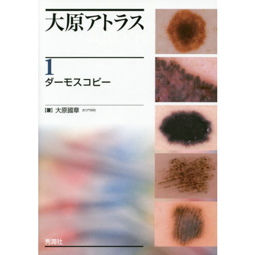大原アトラス １ ダーモスコピー 通販｜セブンネットショッピング