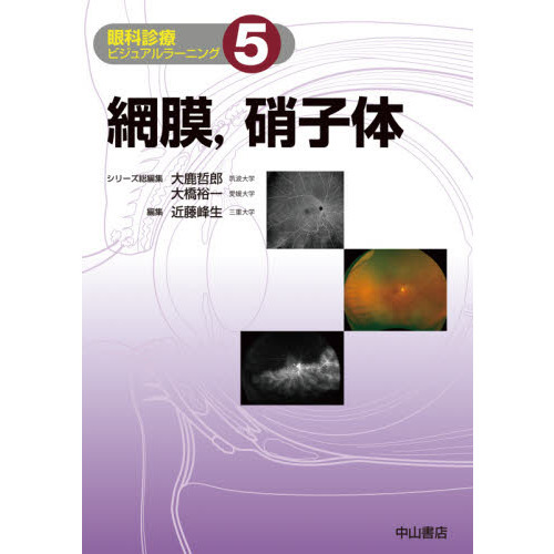 眼科診療ビジュアルラーニング　５　網膜，硝子体