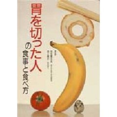 胃を切った人の食事と食べ方