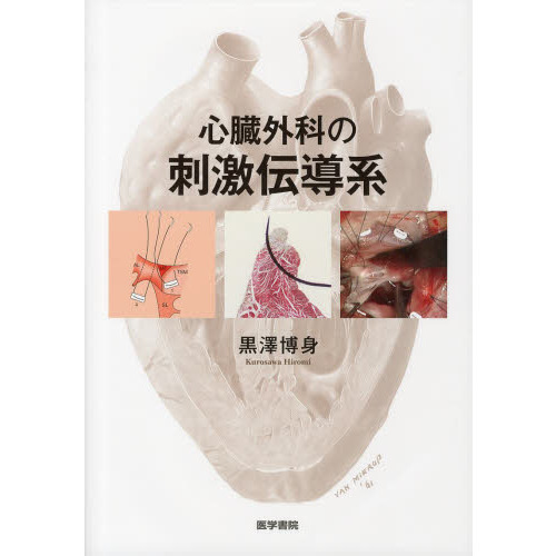 心臓外科の刺激伝導系 心臓外科の刺激伝導系 通販｜セブンネットショッピング