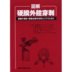 図解硬膜外腔穿刺　硬膜外麻酔・鎮痛治療を効率よく行うために