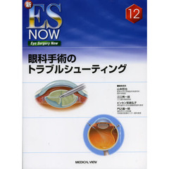 眼科手術のトラブルシューティング