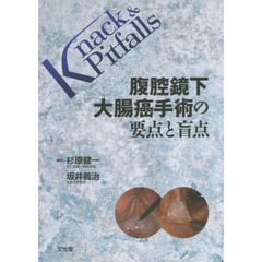 腹腔鏡下大腸癌手術の要点と盲点
