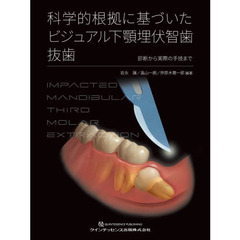 科学的根拠に基づいたビジュアル下顎埋伏智歯抜歯　診断から実際の手技まで