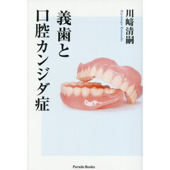 義歯と口腔カンジダ症