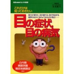 これだけは知っておきたい　目の症状・目の