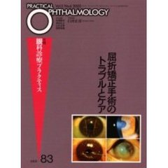 屈折矯正手術のトラブルとケア