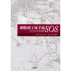 網膜硝子体手術ＳＯＳ　トラブルとその対策