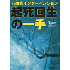 心血管インターベンション起死回生の一手