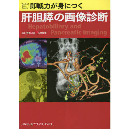 即戦力が身につく肝胆膵の画像診断 通販｜セブンネットショッピング