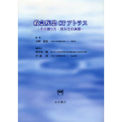 救急疾患ＣＴアトラス　その撮り方・読み方の実際