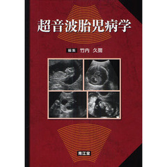 超音波胎児病学