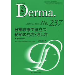 デルマ　Ｎｏ．２３７（２０１５年１１月号）　日常診療で役立つ結節の見方・治し方