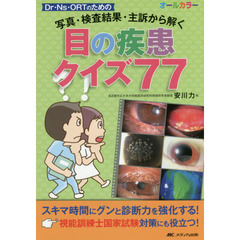 目の疾患クイズ７７　写真・検査結果・主訴から解く　Ｄｒ・Ｎｓ・ＯＲＴのための