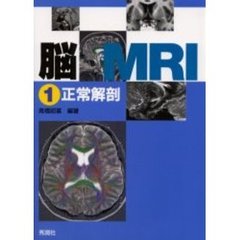 脳ＭＲＩ　１　正常解剖