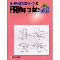 肝移植のｕｐ　ｔｏ　ｄａｔｅ