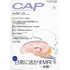 ＣＡＰ　２１６