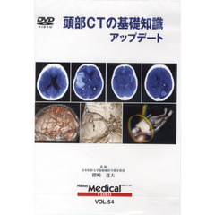 ＤＶＤ　頭部ＣＴの基礎知識アップデート