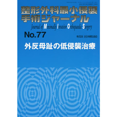 整形外科最小侵襲手術ジャーナル　Ｎｏ．７７　外反母趾の低侵襲治療
